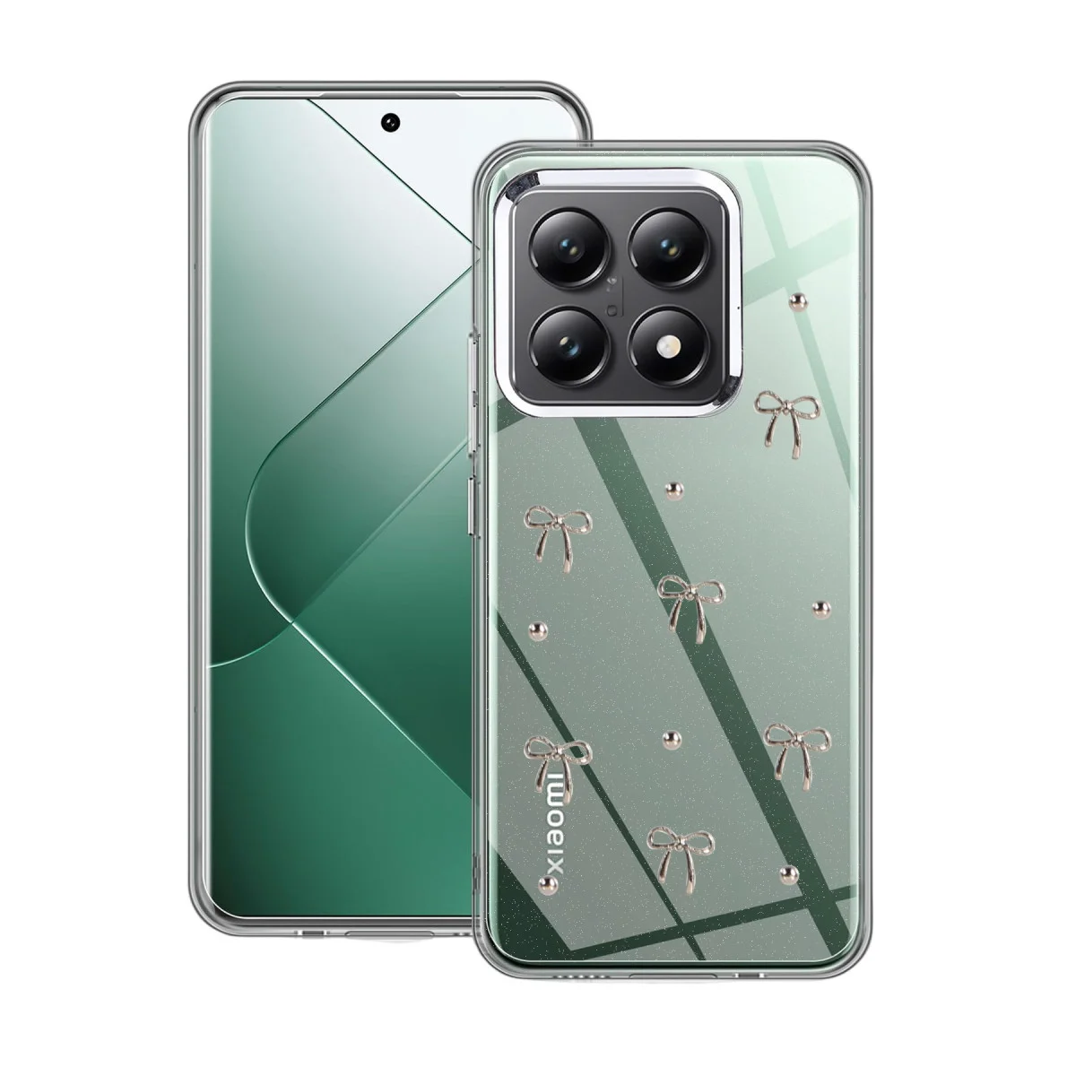Mi 14T Pro Fiyonk Desenli Kapak - Desen 5