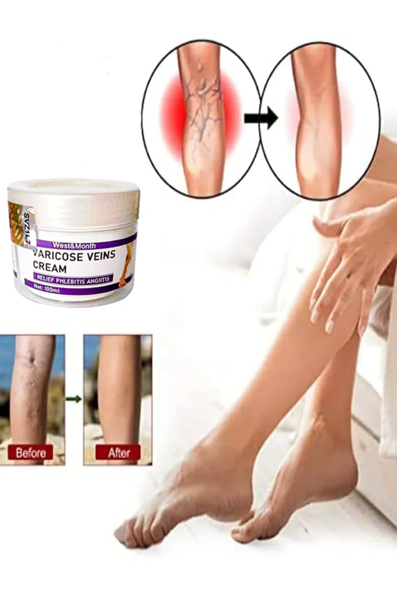 Varix Varicose Veins Purple Bakım Kremi 100 ml
