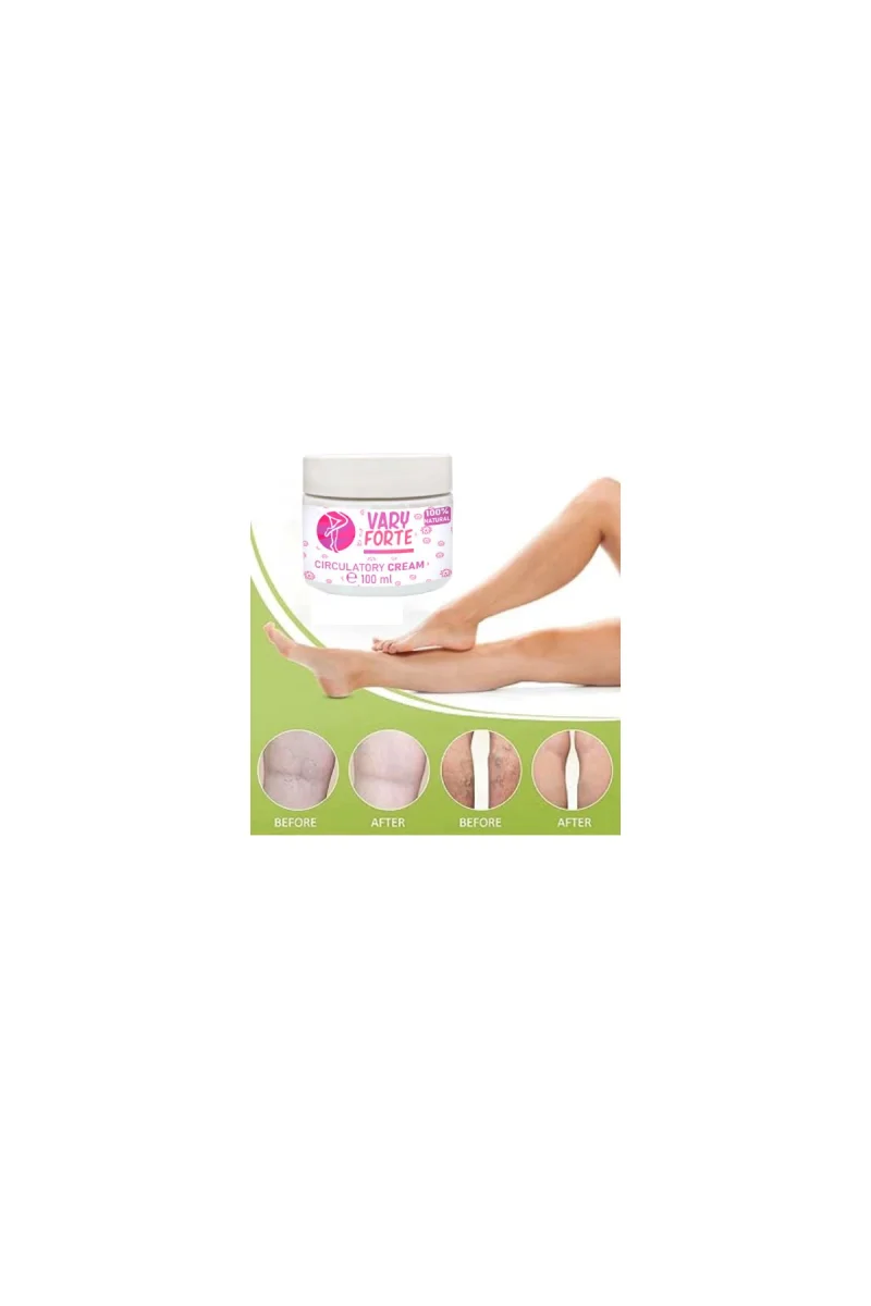 Vary Forte Kavanoz Krem 100 ml Yoğun Varislere Karşı Tesirli Krem