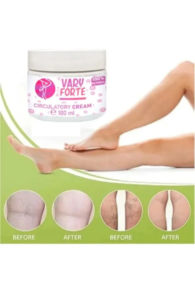 Vary Forte Kavanoz Yoğun Warislere Karşı Tesirli Krem 100 ml X 3 ADET