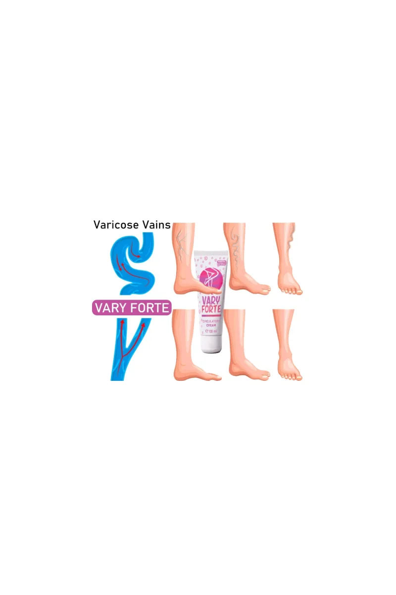 Vary Forte Tüp Krem 100 ml 2 Adet Yoğun Varislerinize Güçlü Tesirli Krem