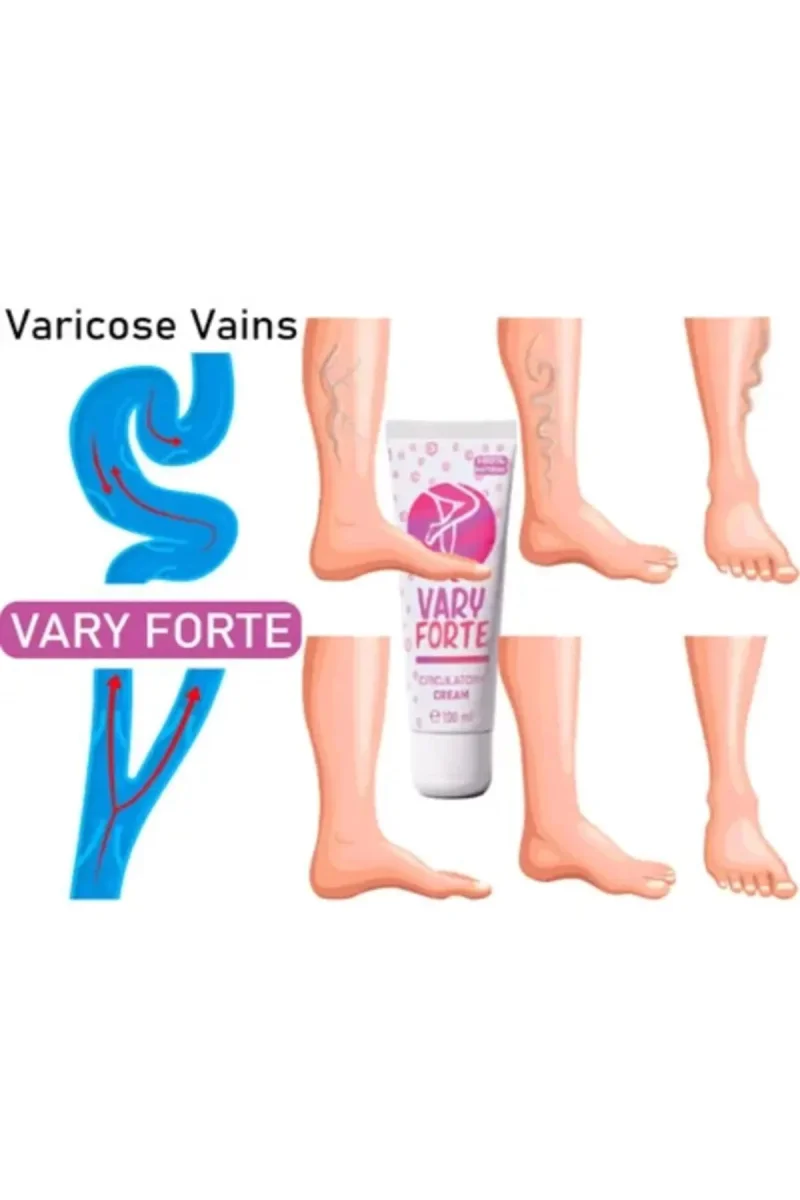 Vary Forte Tüp Yoğun Varislerinize Güçlü Etkide Krem 100 ml 2 ADET