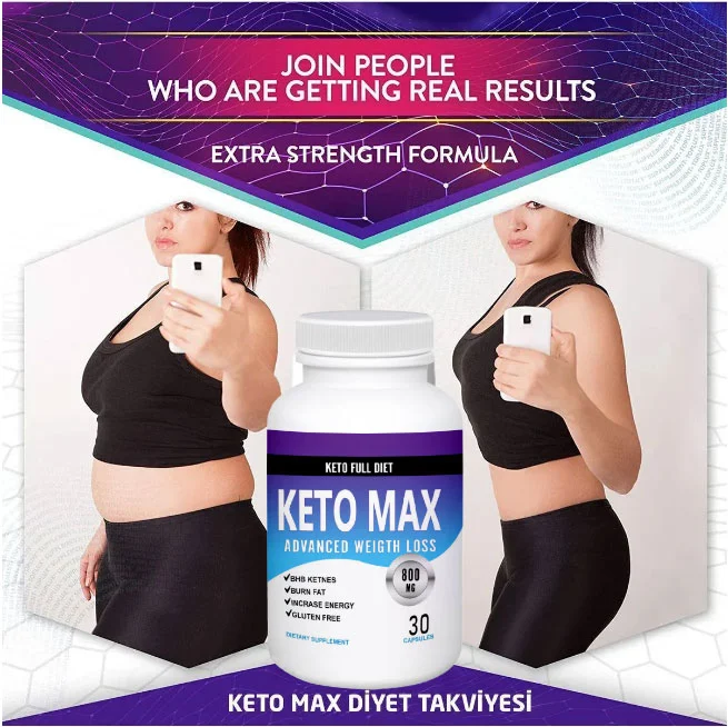 Keto Max 30lu Destekleyici Takviye Edici