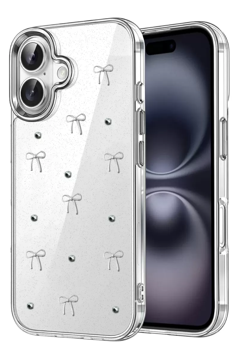 Newface Apple iPhone 16 Plus Fiyonk Desenli Kapak - Desen 5