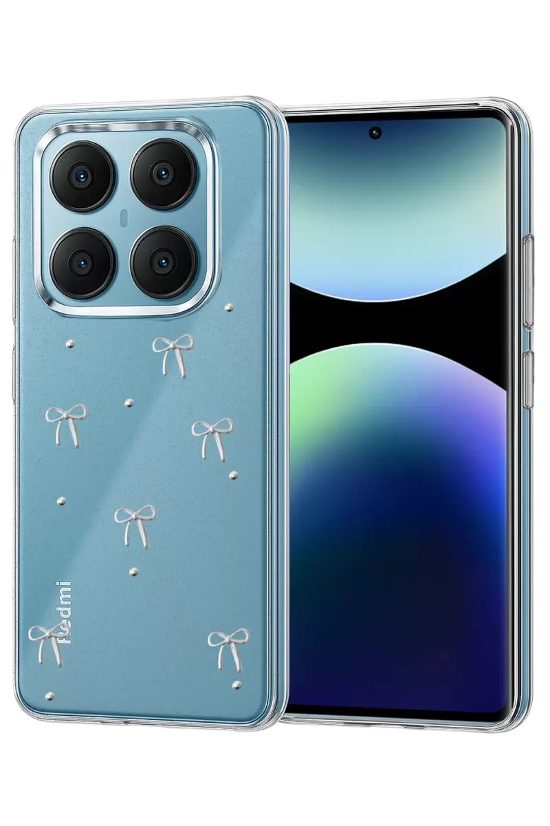 Newface Xiaomi Redmi Note 14 Pro 4G Fiyonk Desenli Kapak - Desen 5