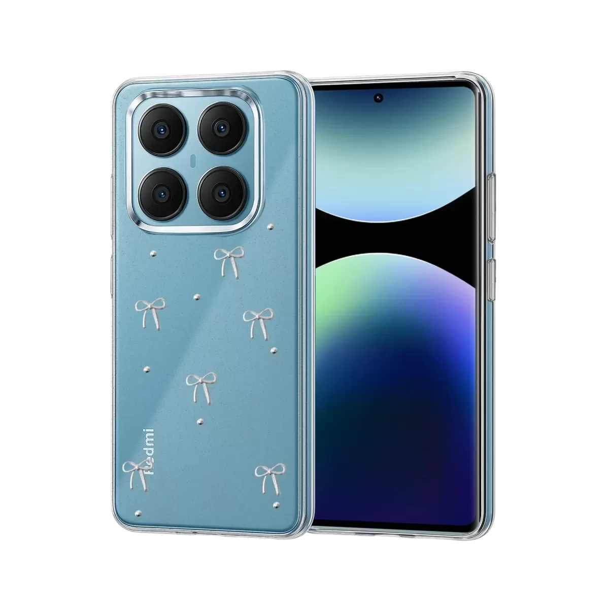 Newface Xiaomi Redmi Note 14 Pro 4G Fiyonk Desenli Kapak - Desen 5
