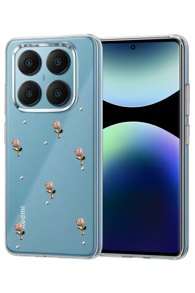 Newface Xiaomi Redmi Note 14 Pro 4G Fiyonk Desenli Kapak - Desen 6