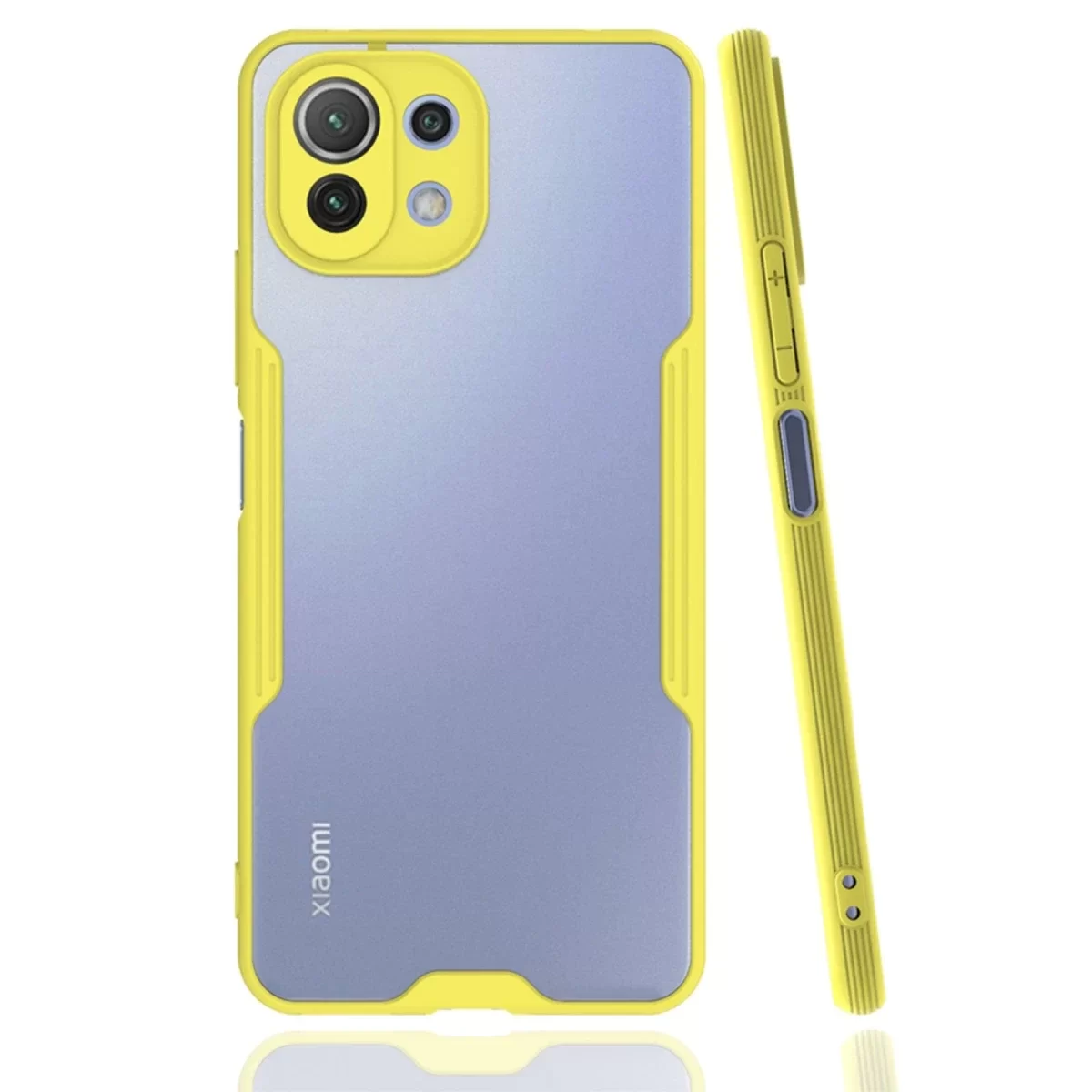Newface Xiaomi Mİ 11 Lite Kılıf Platin Silikon - Sarı