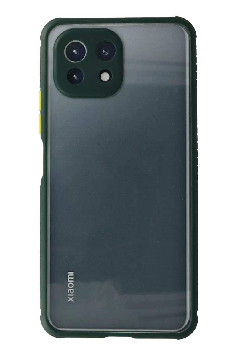 Newface Xiaomi Mİ 11 Lite Kılıf Miami Şeffaf Silikon - Koyu Yeşil