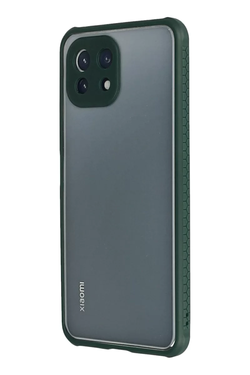 Newface Xiaomi Mİ 11 Lite Kılıf Miami Şeffaf Silikon - Koyu Yeşil