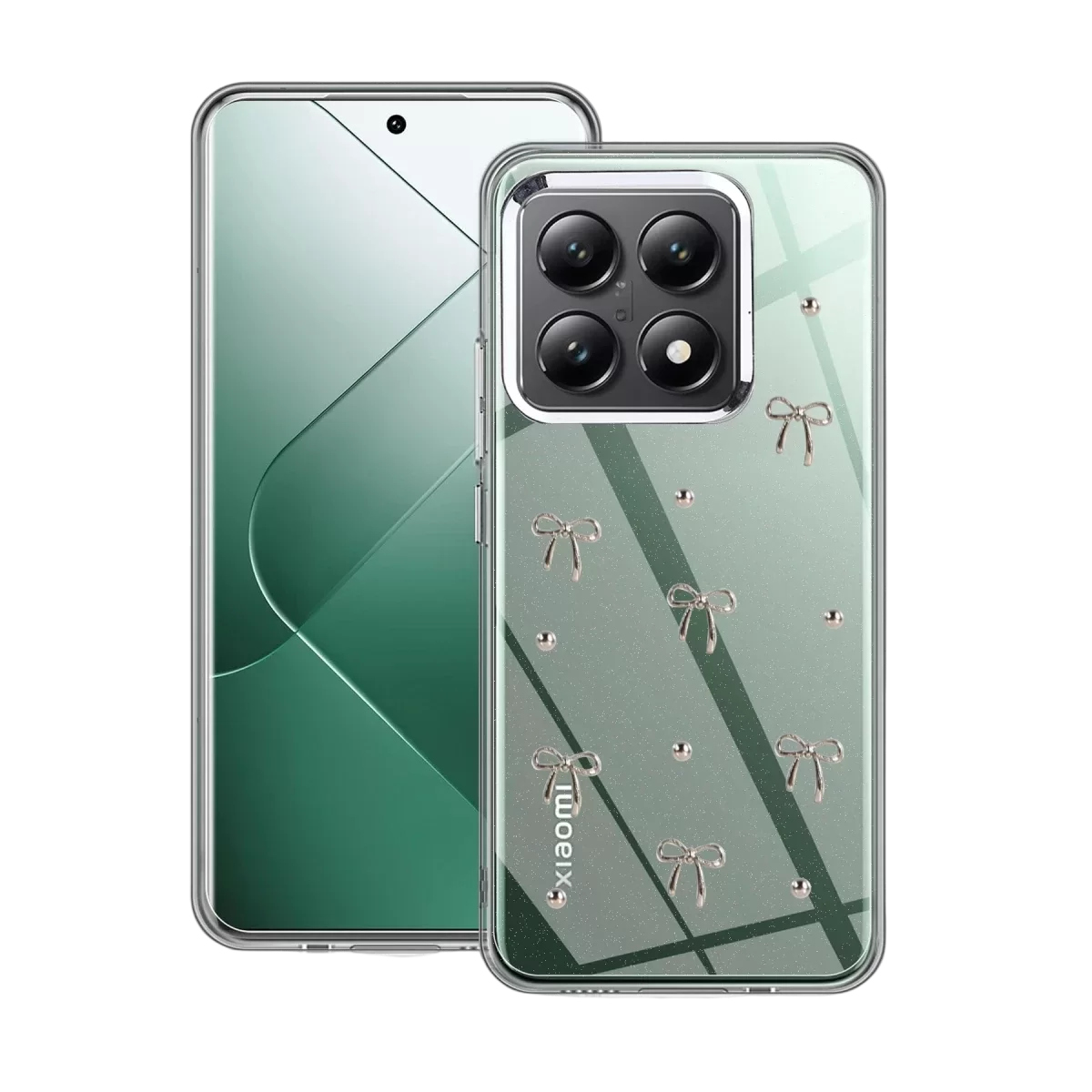 Newface Xiaomi Mi 14T Pro Fiyonk Desenli Kapak - Desen 5