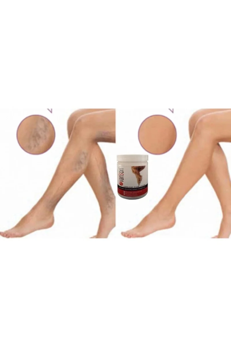 On  Selüllit Bacak Bakım Kremi 200 ml X 2adet