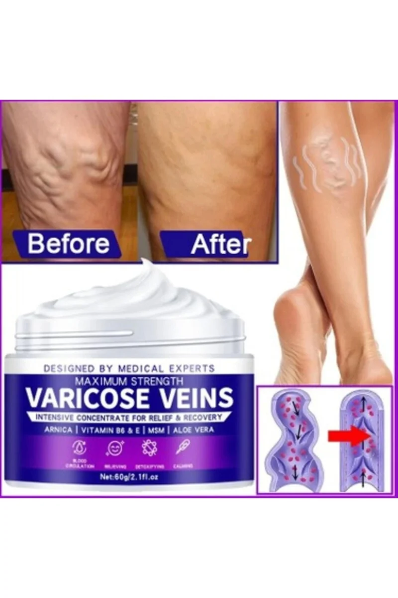 Strength Varicose Vein Tedavi Kremi 100 Ml X 2 ADET