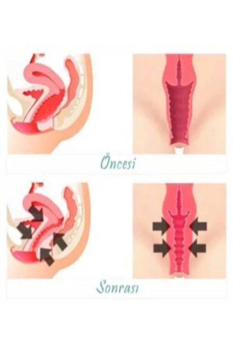 Vagitight Kadınlar İçin Genital Bölge Şekillendirici Krem 100 ml X 2 ADET