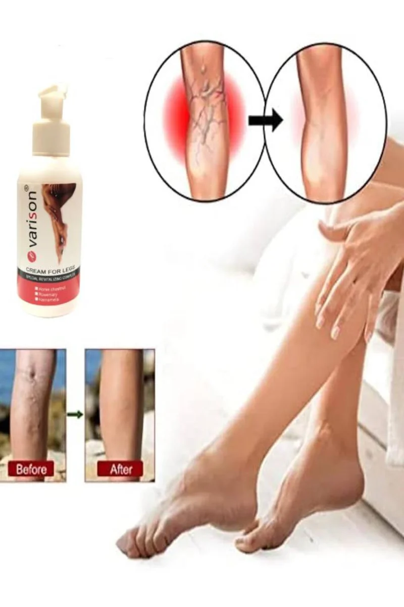 Varison Vari.s Sellülit Bacak Bakım Kremi 120 ml